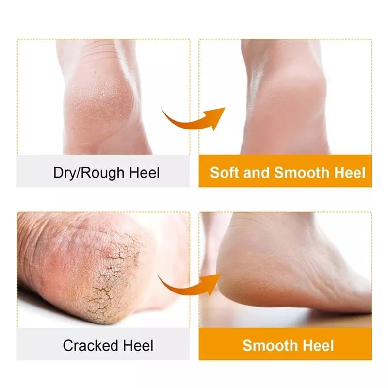 High Quality - Silicone Gel Pad Socks for Pain Relief and anti crack - 1 Pair